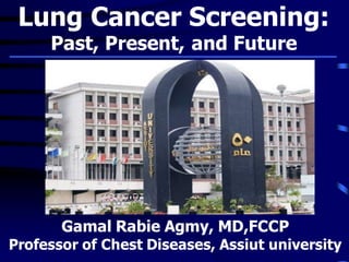 Lung Cancer Screening:
Past, Present, and Future
Gamal Rabie Agmy, MD,FCCP
Professor of Chest Diseases, Assiut university
 