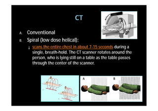 A.   Conventional
B.   Spiral (low dose helical):
     ¡   scans the entire chest in about 7-15 seconds during a
         single, breath-hold. The CT scanner rotates around the
         person, who is lying still on a table as the table passes
         through the center of the scanner.
 