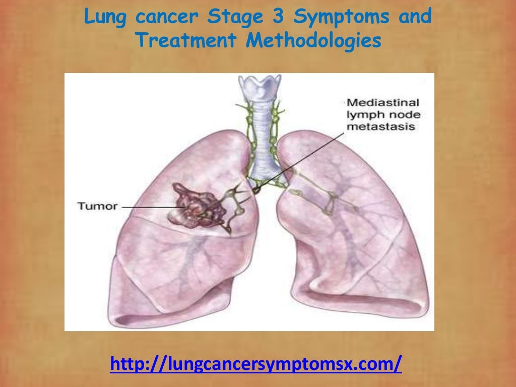 Lung cancer stage 3 symptoms and treatment methodologies