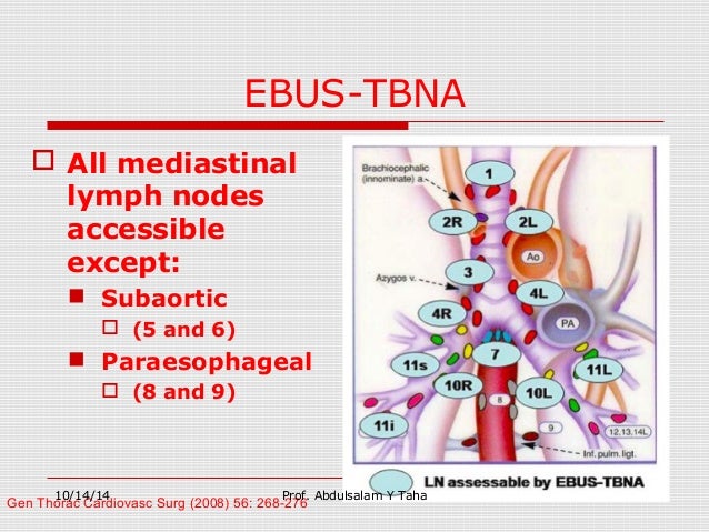 mediastinal lymph nodes
