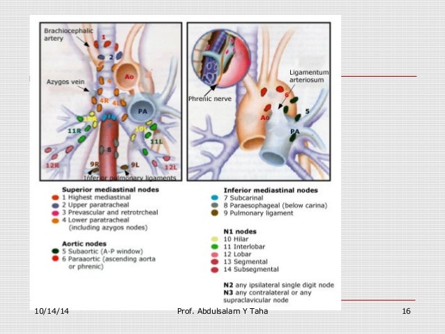 Image Result For Stages Of Lung Cancer Image Result For Stages Of Lung Cancer