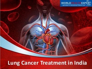 Lung Cancer Treatment in India
 