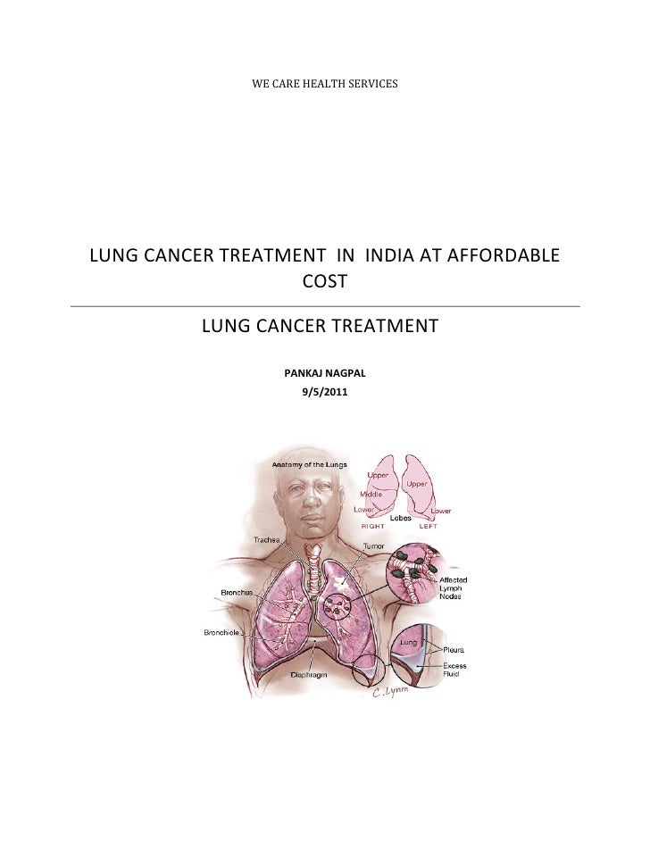 Lung cancer treatment in india at mumbai at low cost