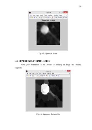 33
Fig 4.3: Upsample Image
4.4 SUPERPIXEL FORMULATION
Super pixel formulation is the process of dividing an image into multiple
segments
Fig 4.4: Superpixel Formulation
 