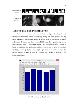 37
4.8 PERFORMANCE CHARECTERISTICS
Patch based context analysis method is developed for diagnosis and
classification of candidate nodules after applying training and testing process. The lung
tumour diagnosis is an important criterion in medical field. In this project, we detect
and segment the tumour area from the lung LDCT image. The segmented lung tumour
can be classified using SVM and LSA classifier. Then the lung tumours are classified as
benign or malignant. The performance analysis is carried out in terms of sensitivity,
specificity, positive predictive value, negative predictive value and Accuracy. The
average accuracy achieved is 89% for malignant tumor region in accordance with
ground truth images.
Fig 4.8: Performance characteristics
DOWN SAMPLE
IMAGE
CLASSIFIED
RESULT
 
