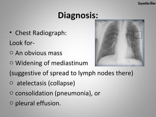 Sayantika Dhar


                Diagnosis:
• Chest Radiograph:
Look for- 
o An obvious mass
o Widening of mediastinum
(suggestive of spread to lymph nodes there)
o  atelectasis (collapse)
o consolidation (pneumonia), or 
o pleural effusion.
 