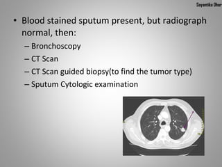 Sayantika Dhar


• Blood stained sputum present, but radiograph 
  normal, then:
  – Bronchoscopy
  – CT Scan
  – CT Scan guided biopsy(to find the tumor type)
  – Sputum Cytologic examination
 