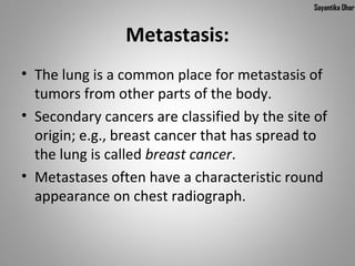 Sayantika Dhar


                Metastasis:
• The lung is a common place for metastasis of
  tumors from other parts of the body.
• Secondary cancers are classified by the site of
  origin; e.g., breast cancer that has spread to
  the lung is called breast cancer.
• Metastases often have a characteristic round
  appearance on chest radiograph.
 