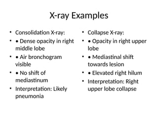X-ray Examples
• Consolidation X-ray:
• • Dense opacity in right
middle lobe
• • Air bronchogram
visible
• • No shift of
mediastinum
• Interpretation: Likely
pneumonia
• Collapse X-ray:
• • Opacity in right upper
lobe
• • Mediastinal shift
towards lesion
• • Elevated right hilum
• Interpretation: Right
upper lobe collapse
 