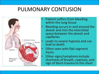 PULMONARY CONTUSION
