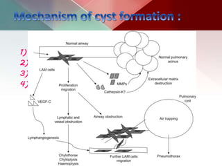 1) Necrosis of lung parenchyma.
2) Communication with the tracheobronchial tree.
3) Complete destruction.
4) Band of inflammation around the necrotic
material.
 