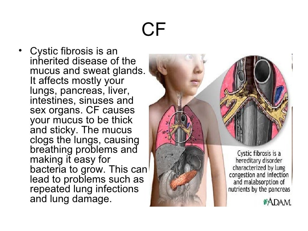 Lung disease