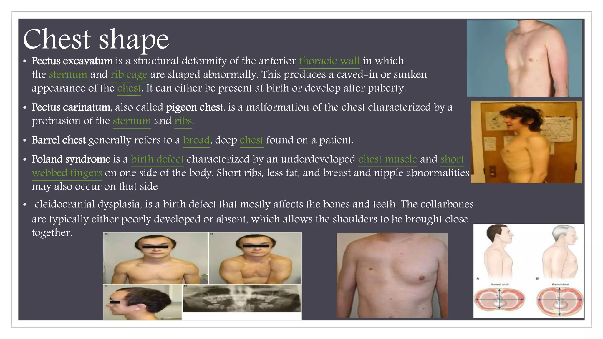 chest & Lung examination | PPTX