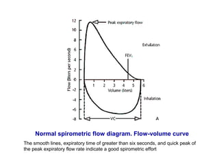 Spirometry Normal Pattern Lung fuction tests | PPT