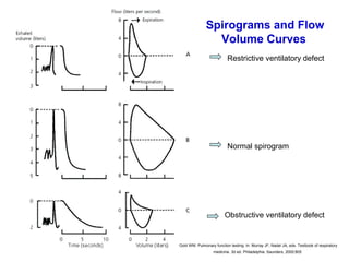 Spirograms and Flow
Volume Curves
Gold WM. Pulmonary function testing. In: Murray JF, Nadel JA, eds. Textbook of respiratory
medicine. 3d ed. Philadelphia: Saunders, 2000:805
Restrictive ventilatory defect
Normal spirogram
Obstructive ventilatory defect
 