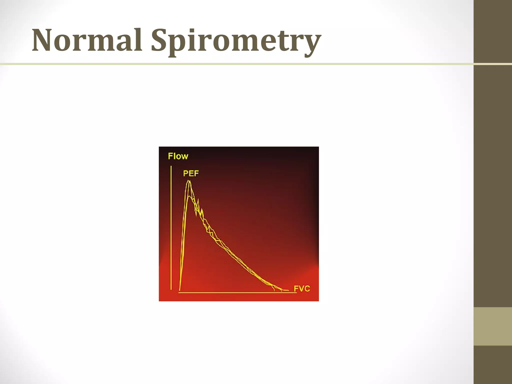 Normal Spirometry
 