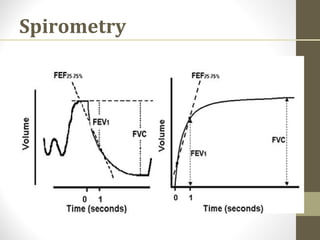 Spirometry
 