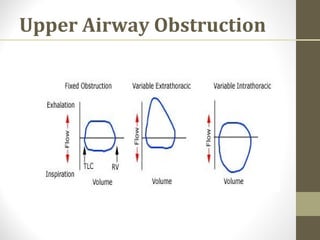 Upper Airway Obstruction
 