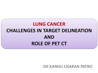 LUNG CANCER
CHALLENGES IN TARGET DELINEATION
AND
ROLE OF PET CT
DR KANHU CHARAN PATRO
1
 