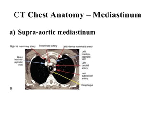 CT Chest Anatomy – Mediastinum
a) Supra-aortic mediastinum
 