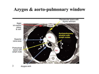 Azygos & aorto-pulmonary window
 