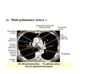 c) Main pulmonary artery :-
 