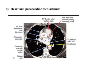 d) Heart and paracardiac mediastinum
 