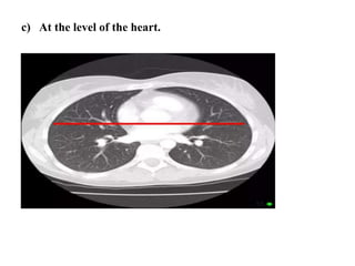 c) At the level of the heart.
 