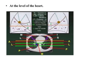 • At the level of the heart.
 