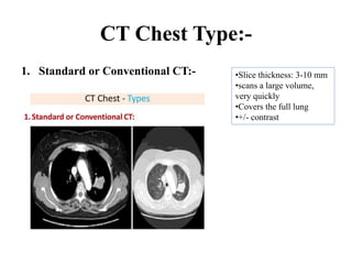 CT Chest Type:-
1. Standard or Conventional CT:- •Slice thickness: 3-10 mm
•scans a large volume,
very quickly
•Covers the full lung
•+/- contrast
 