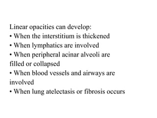 Linear opacities can develop:
• When the interstitium is thickened
• When lymphatics are involved
• When peripheral acinar alveoli are
filled or collapsed
• When blood vessels and airways are
involved
• When lung atelectasis or fibrosis occurs
 