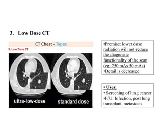 3. Low Dose CT
• Uses:
• Screening of lung cancer
•F/U: Infection, post lung
transplant, metastasis
•Premise: lower dose
radiation will not reduce
the diagnostic
functionality of the scan
(eg. 250 mAs 50 mAs)
•Detail is decreased
 