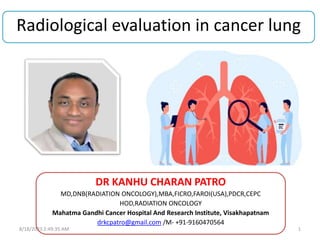 Radiological evaluation in cancer lung
DR KANHU CHARAN PATRO
MD,DNB(RADIATION ONCOLOGY),MBA,FICRO,FAROI(USA),PDCR,CEPC
HOD,RADIATION ONCOLOGY
Mahatma Gandhi Cancer Hospital And Research Institute, Visakhapatnam
drkcpatro@gmail.com /M- +91-9160470564
8/18/2023 2:49:35 AM 1
 