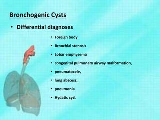 Bronchogenic Cysts
• Differential diagnoses
• Foreign body
• Bronchial stenosis
• Lobar emphysema
• congenital pulmonary airway malformation,
• pneumatocele,
• lung abscess,
• pneumonia
• Hydatic cyst
 