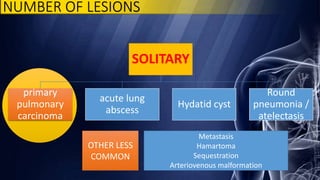 NUMBER OF LESIONS
SOLITARY
primary
pulmonary
carcinoma
acute lung
abscess
Hydatid cyst
Round
pneumonia /
atelectasis
OTHER LESS
COMMON
Metastasis
Hamartoma
Sequestration
Arteriovenous malformation
 