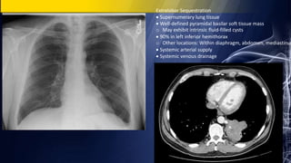 Extralobar Sequestration
 Supernumerary lung tissue
 Well-defined pyramidal basilar soft tissue mass
o May exhibit intrinsic fluid-filled cysts
 90% in left inferior hemithorax
o Other locations: Within diaphragm, abdomen, mediastinum
 Systemic arterial supply
 Systemic venous drainage
 