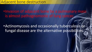 •Invasion of adjacent bone by a pulmonary mass
is almost pathognomonic of lung cancer.
•Actinomycosis and occasionally tuberculosis or
fungal disease are the alternative possibilities.
Adjacent bone destruction
 