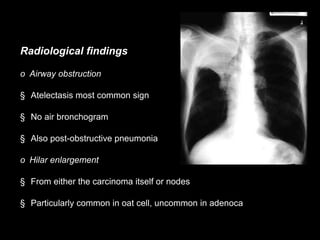 Radiological findings
o Airway obstruction
§ Atelectasis most common sign
§ No air bronchogram
§ Also post-obstructive pneumonia
o Hilar enlargement
§ From either the carcinoma itself or nodes
§ Particularly common in oat cell, uncommon in adenoca
 