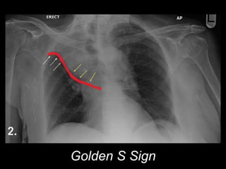 Golden S Sign
 