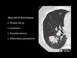 o Alveolar cell ca
o Lymphoma
o Pseudolymphoma
o Inflammatory pseudotumor
 