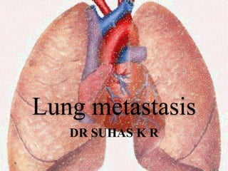 Lung metastasis
DR SUHAS K R
 