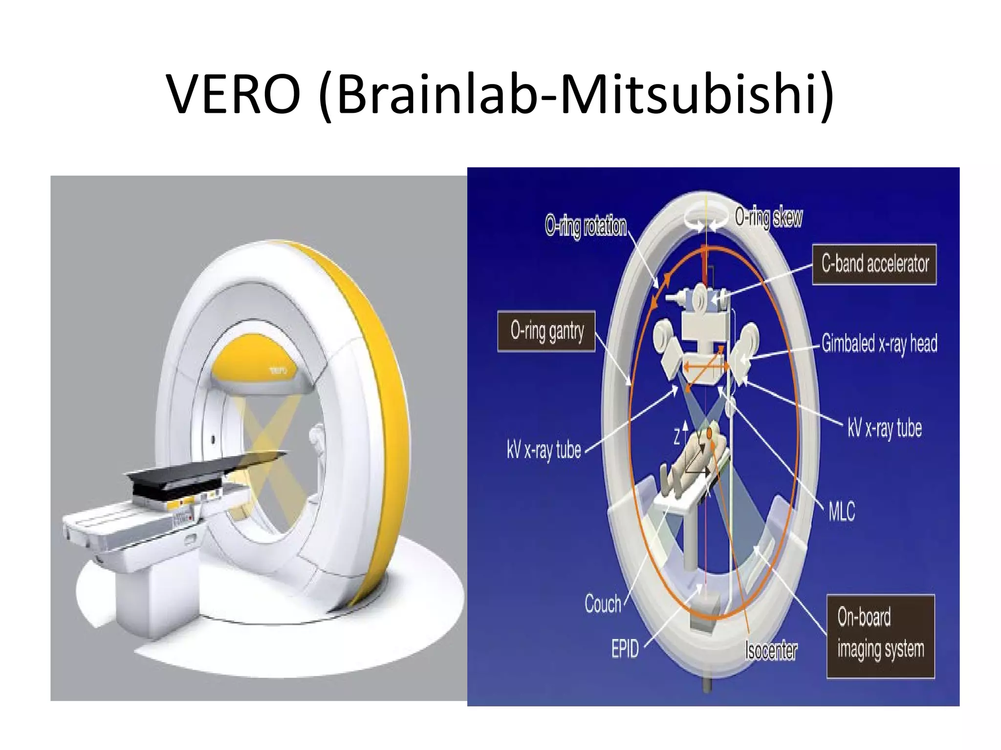 VERO (Brainlab-Mitsubishi)
 