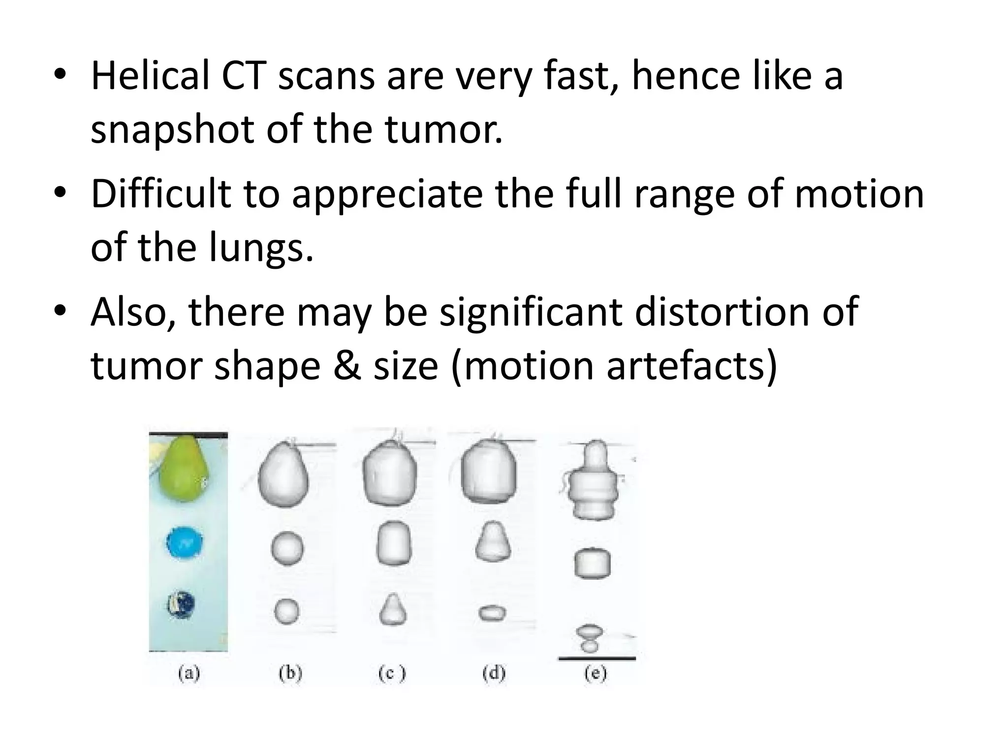 • Helical CT scans are very fast, hence like a
snapshot of the tumor.
• Difficult to appreciate the full range of motion
of the lungs.
• Also, there may be significant distortion of
tumor shape & size (motion artefacts)
 