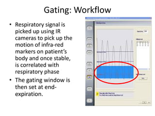 Gating: Workflow
• Respiratory signal is
picked up using IR
cameras to pick up the
motion of infra-red
markers on patient’s
body and once stable,
is correlated with
respiratory phase
• The gating window is
then set at end-
expiration.
 