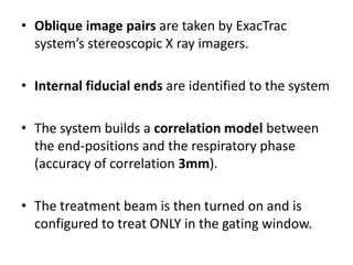 • Oblique image pairs are taken by ExacTrac
system’s stereoscopic X ray imagers.
• Internal fiducial ends are identified to the system
• The system builds a correlation model between
the end-positions and the respiratory phase
(accuracy of correlation 3mm).
• The treatment beam is then turned on and is
configured to treat ONLY in the gating window.
 
