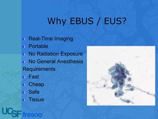 Why EBUS / EUS?
Real-Time Imaging
Portable
No Radiation Exposure
No General Anesthesia
Requirements
Fast
Cheap
Safe
Tissue
 