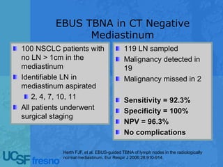EBUS TBNA in CT Negative
Mediastinum
100 NSCLC patients with
no LN > 1cm in the
mediastinum
Identifiable LN in
mediastinum aspirated
2, 4, 7, 10, 11
All patients underwent
surgical staging
119 LN sampled
Malignancy detected in
19
Malignancy missed in 2
Sensitivity = 92.3%
Specificity = 100%
NPV = 96.3%
No complications
Herth FJF, et al. EBUS-guided TBNA of lymph nodes in the radiologically
normal mediastinum. Eur Respir J 2006;28:910-914.
 