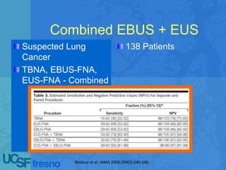Combined EBUS + EUS
Suspected Lung
Cancer
TBNA, EBUS-FNA,
EUS-FNA - Combined
138 Patients
Wallace et al. JAMA 2008;299(5):540-546.
 