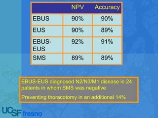 EBUS-EUS diagnosed N2/N3/M1 disease in 24
patients in whom SMS was negative
Preventing thoracotomy in an additional 14%
 