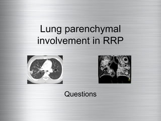 Lung parenchymal
involvement in RRP




     Questions
 